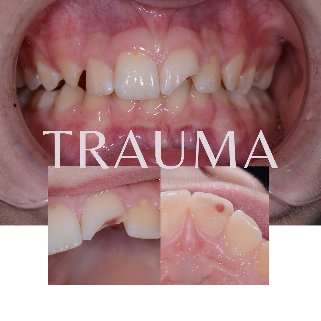 Patient 8 transformation